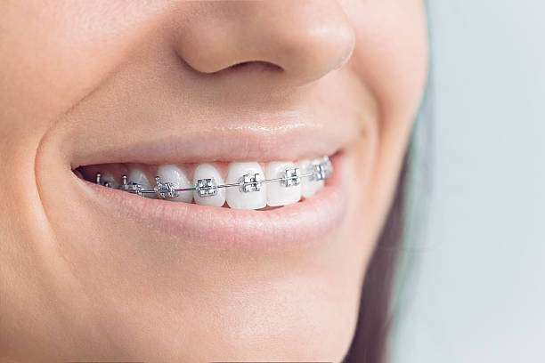 Best Dental Exams and Cleanings  in Severna Park, MD